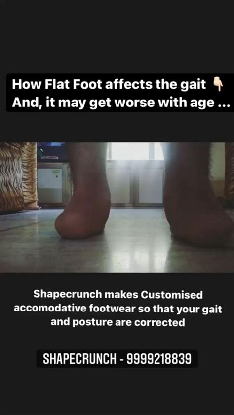 How Flat Foot Affects The Posture And Gait Feet Therapy Feet Care Foot Health