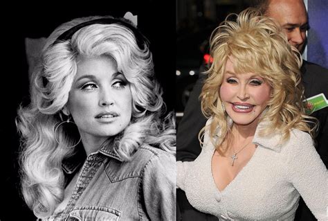 How Many Facelifts Has Dolly Parton Had Telegraph