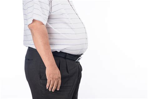 Perut Pria Gemuk Close Up Ditembak Lemak Obesitas Kelebihan Berat Badan