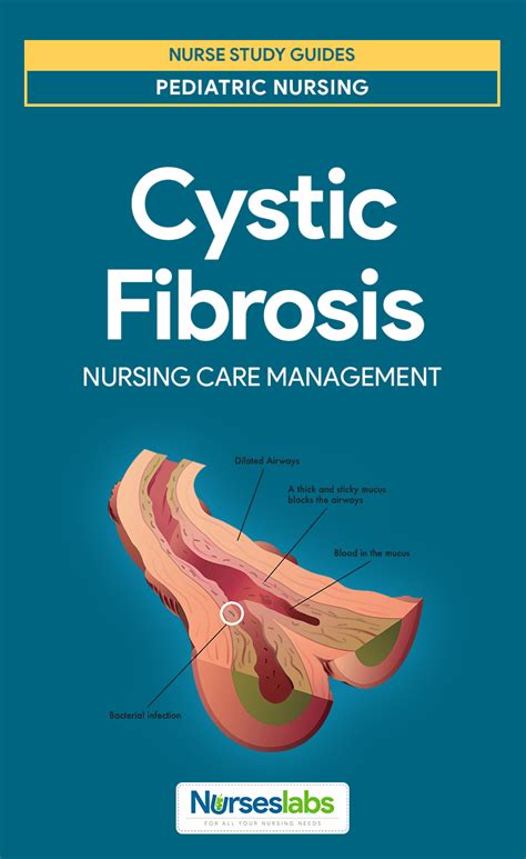 Cystic Fibrosis Nursing Care Management Study Guide Nursing Care
