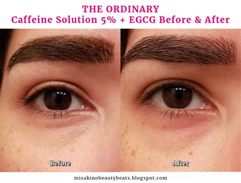 Caffeine is supposed to work on reducing puffiness, fighting free radicals, and reducing dark under eye circles. Review: The Ordinary Caffeine Solution 5% + EGCG - MISAKINO