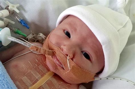 Miracle Baby Makes Amazing Recovery From Open Heart Surgery At One