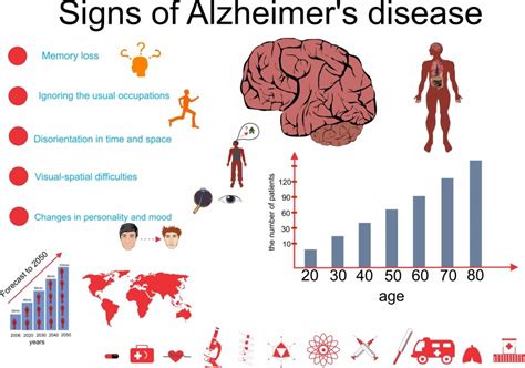 Causes And Signs Of Alzheimers Disease Alldaychemist Online Pharmacy