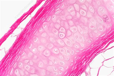 Hyaline Cartilage Light Micrograph Stock Image C032 0446 Science
