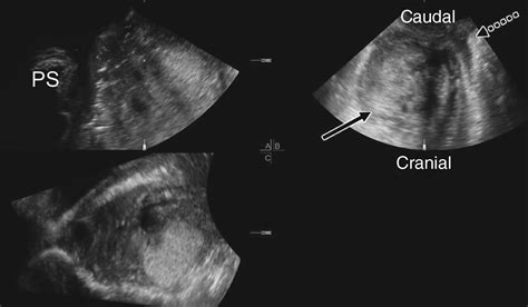 Two‐ And Three‐dimensional Transperineal Ultrasound As Complementary