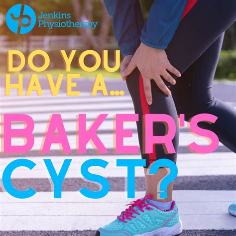Bakers Cyst Treatment Perth Jenkins Physio Jenkins Physio Blog