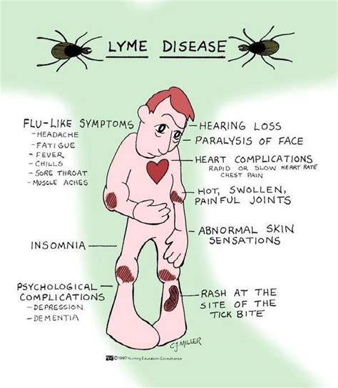 Lyme Disease Pediatric Nursing Nursing School Survival Nursing
