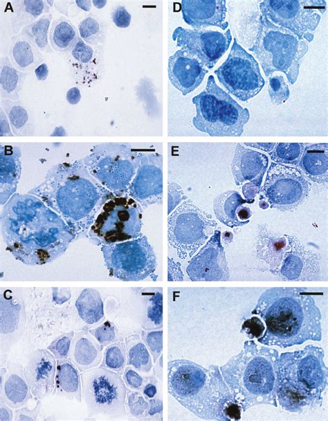 Immunolabeling Of Thp 1 Monocyte Cell Line Infected With C Pneumoniae
