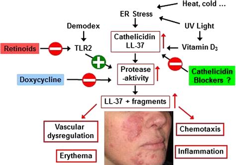 New Insights Into Rosacea Pathophysiology A Review Of Recent Findings