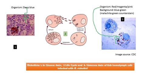 Rickettsia Introduction Morphology Pathogenesis Complications Labora