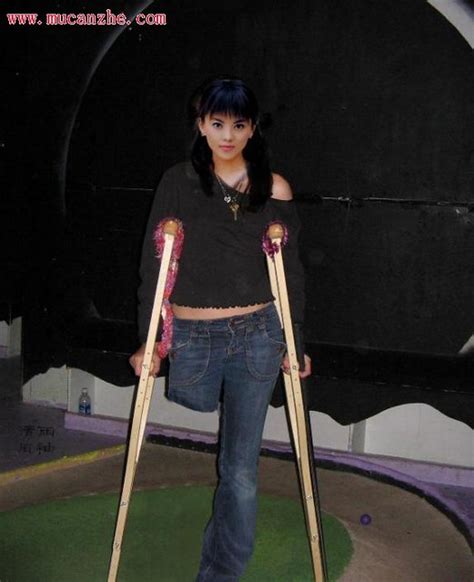 Sak Amputee Women On Crutches Images