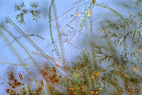 Batrachospermum Algae And Diatoms Light Micrograph Stock Image