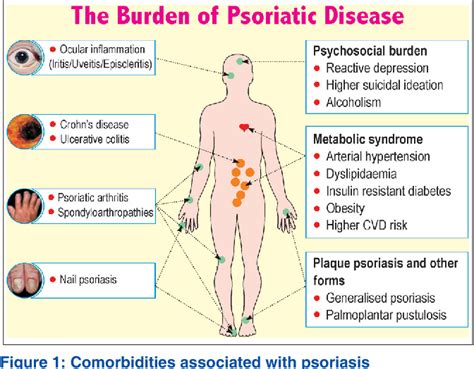 Psoriatic Arthritis Comorbidities Psoriatic Arthritis Comorbidities What Patients Need To Know