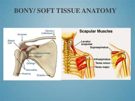 Sick Scapula With Clavicle Fractures Case Study Presentation 201