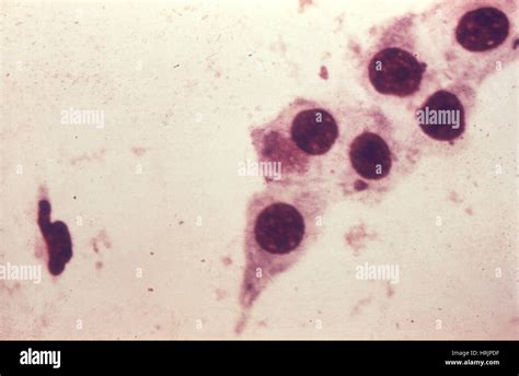 Chlamydia Trachomatis Bacteria Lm Stock Photo Alamy