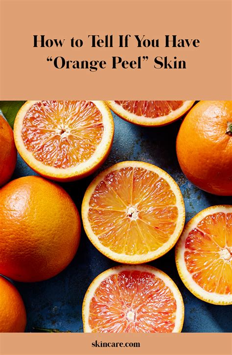 What To Do If You Have Orange Peel Skin Powered By L