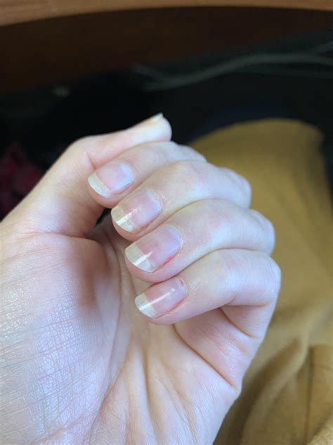 Help For Short Nail Beds I Know Not To Clean Too Deep But What If