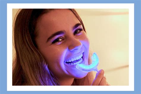 Brighten Your Smile With These Teeth Whitening Kits On Sale Now