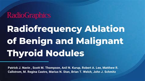 Radiofrequency Ablation Of Benign And Malignant Thyroid Nodules Rfamd