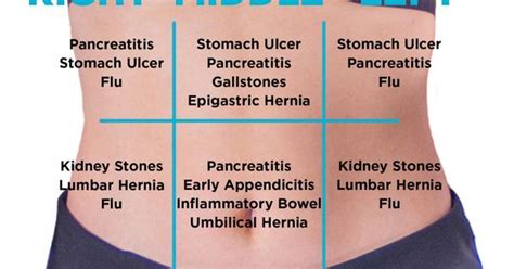 Left Vs Right Back And Abdominal Pain In Women Kidney Stones Flu And