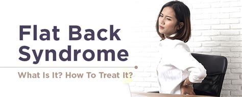 Flat Back Syndrome What Is It How To Treat It