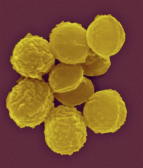 Micrococcus Luteus Photograph By Dennis Kunkel Microscopyscience Photo