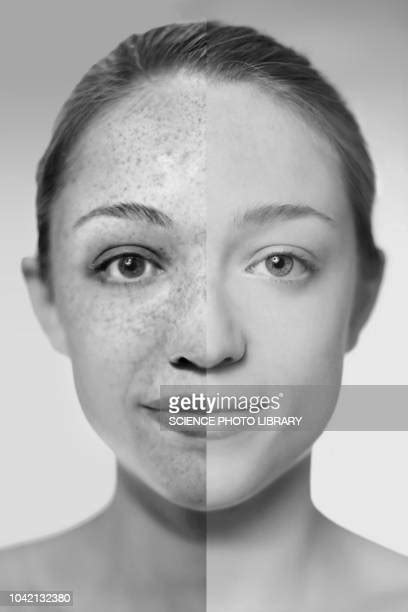 Sun Skin Damage Photos And Premium High Res Pictures Getty Images