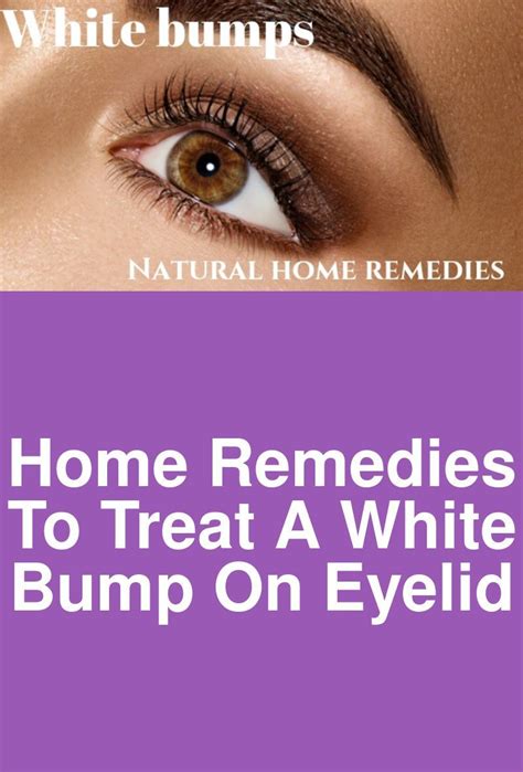 Home Remedies To Treat A White Bump On Eyelid This Article Points Out