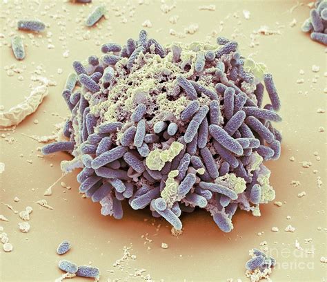 E Coli Bacteria Sem Photograph By Steve Gschmeissner