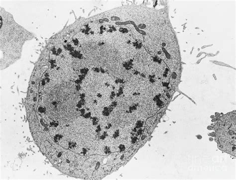 Mitosis Prophase Tem Photograph By David M Phillips Pixels