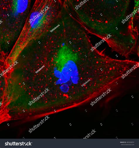 Real Fluorescence Microscopic View Human Skin Stock Photo 465565874