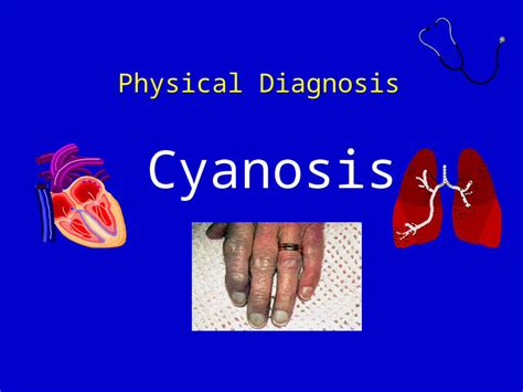 Ppt Physical Diagnosis Cyanosis Definition Cyanosis Refers To A