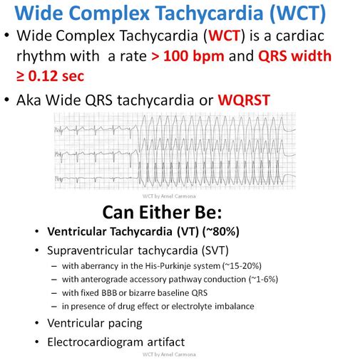 Wide Complex Tachycardia Ecg Definition And Causes Grepmed