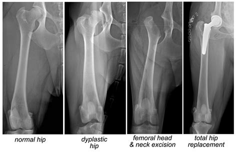 Hip dislocation can also occur in patients after total hip replacement when dislocation of the prosthesis may occur. 31 COST OF SURGERY HIP DYSPLASIA IN DOGS - * Cost