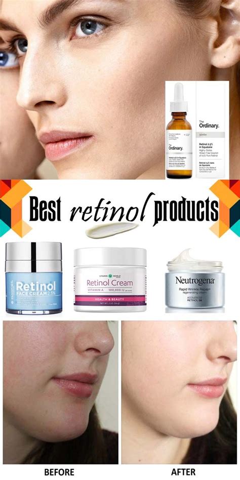 Retinoid Creams For Acne