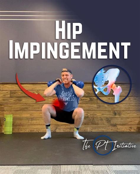 Dr Adam McCluskey PT DPT On Instagram Hip Impingement Swipe