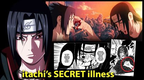The Real Reason Itachi Uchiha Died Itachis Secret Illness Explained