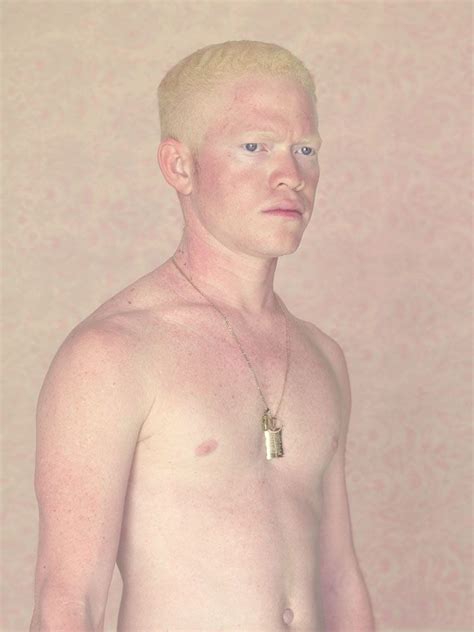 Pin Em Garotos Albinos