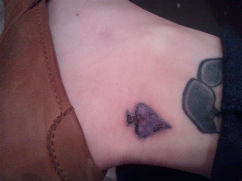 Since the infection can occur deep within the wound, you want to make sure the tattoo doesn't heal on top of it. Day 3 - Infected Tattoo | Flickr - Photo Sharing!