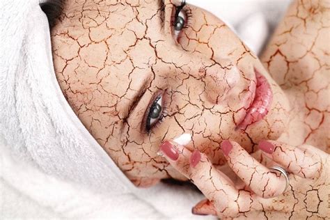 How To Deal With Dry Skin