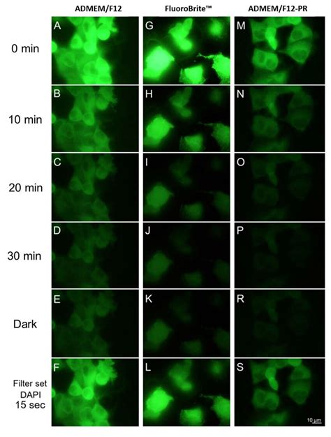 Loss Of Egfp Fluorescence In T Cells Transfected With Actin Egfp Over