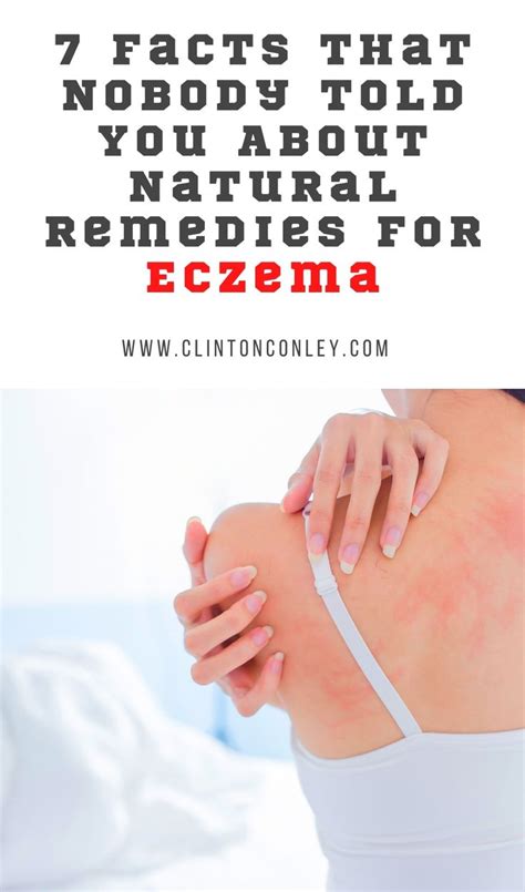 7 Facts That Nobody Told You About Natural Remedies For Eczema Diy