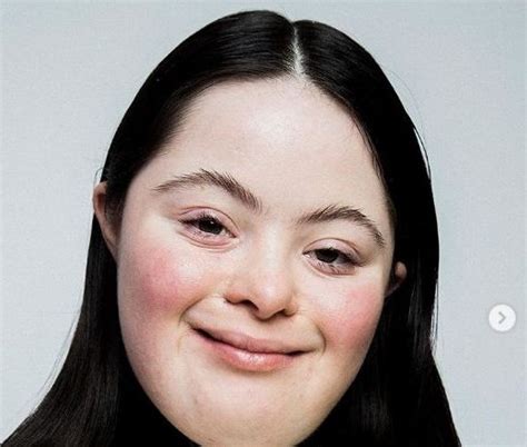 Model With Downs Syndrome Breaks Instagram Records For Gucci Bandt