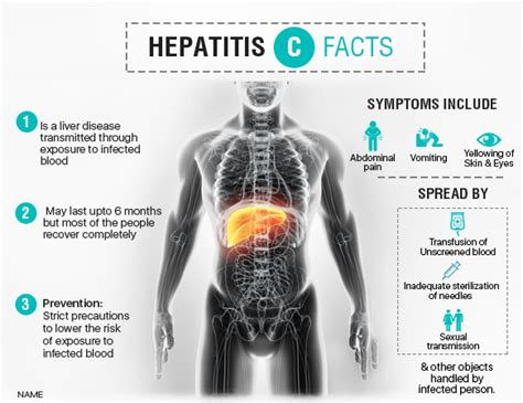 Hepatitis C Risk Symptoms Diagnosis And Treatments Ailbs India