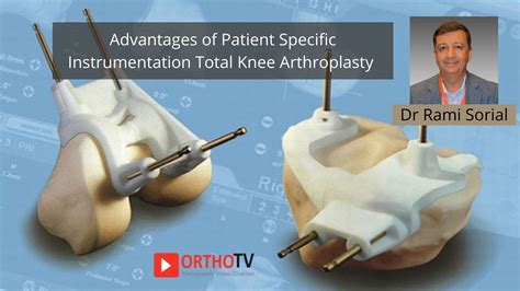 Patient Specific Instrumentation Total Knee Replacement Dr Rami Sorial