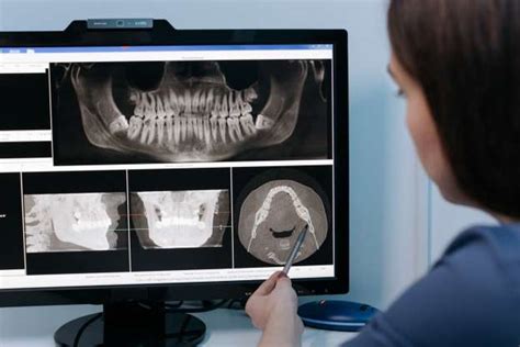 Why Are Dental X Rays So Important