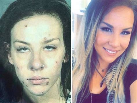 Inspiring Photos Show Drug Users Before And After They Got Clean