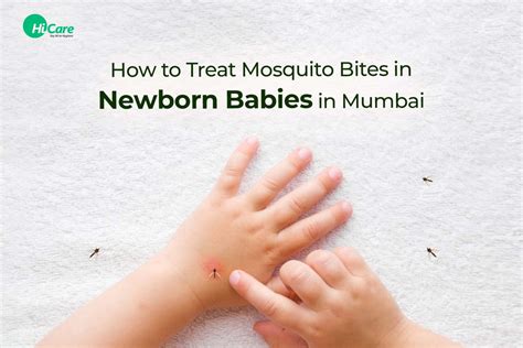 Best Tips To Treat Mosquito Bites In Newborn Babies Hicare