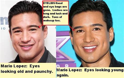 Mario Lopez Plastic Surgery You Be The Judge The Damien Zone