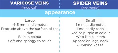 Spider Veins Vs Varicose Veins Recognizing The Difference
